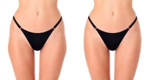 Get rid of saddlebags